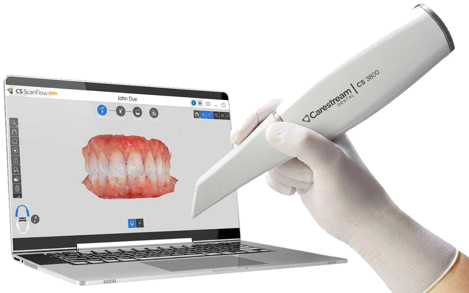اورال اسکنر Carestream CS 3800
